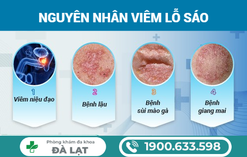 Hình ảnh minh họa